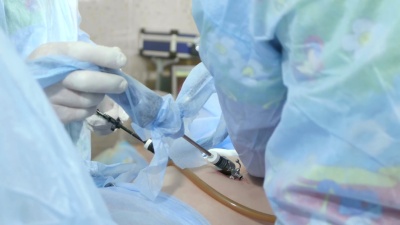 外科医生跟随腹腔镜手术