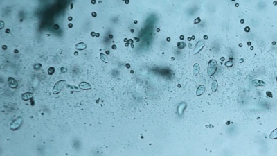 微生物草履虫