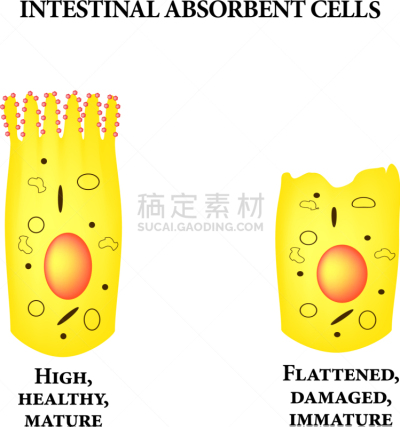肠上皮细胞,细胞,肠内的,专心,健康保健,人,生病