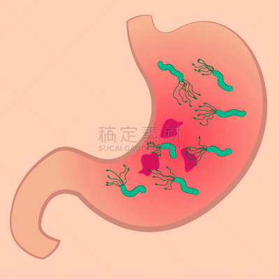 幽门螺旋杆菌,症状,寄生虫感染,簇叶从生的,图像,矢量,天然气,细菌,硫磺