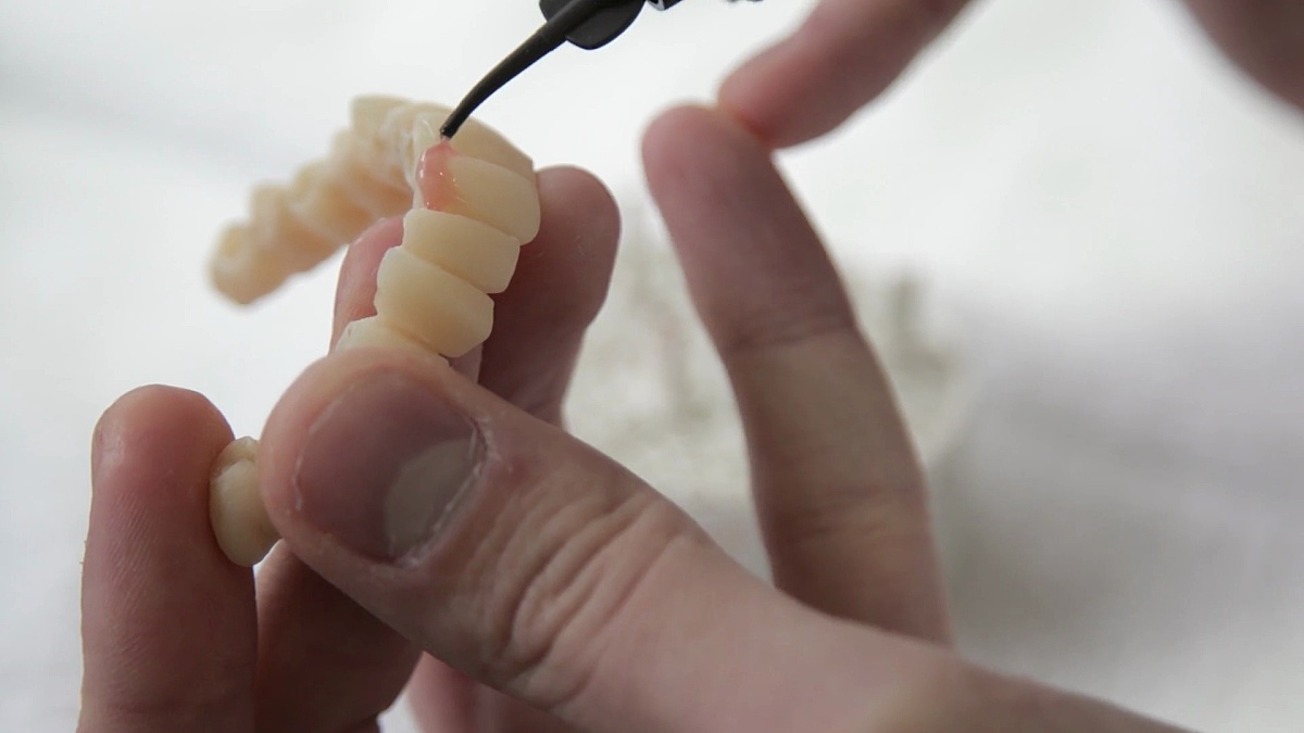 牙科技术员在3D模型上应用牙齿升级