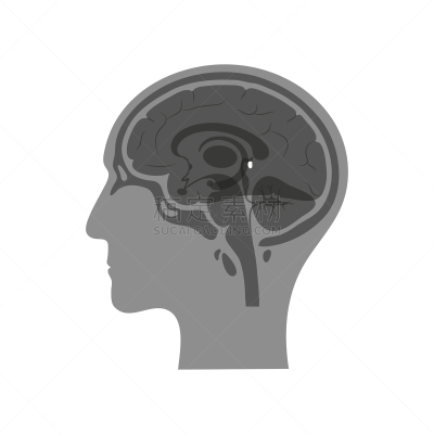松果腺,绘画插图,矢量,分离着色,生物学,有序,健康保健,侧面,半球体,背景分离