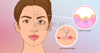 美容院,皱纹,早产儿,动物皮,信息图表,皮肤病学,生病,手术,美容