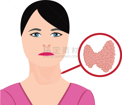 内分泌系统,白色,症状,健康保健,人,碘,Goiter,生病