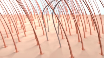 脱发3D动画