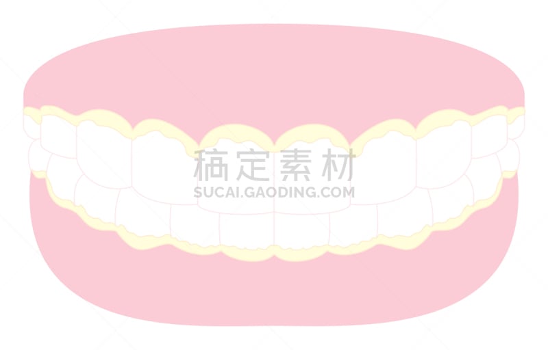 绘画插图,斑块,牙齿,人的牙齿,糯米面包,医药职业,医疗流程,医疗建筑,病毒,诊疗室