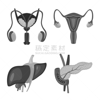 分离着色,里面,医疗标志,人造物,卵巢,泌尿系统,膀胱