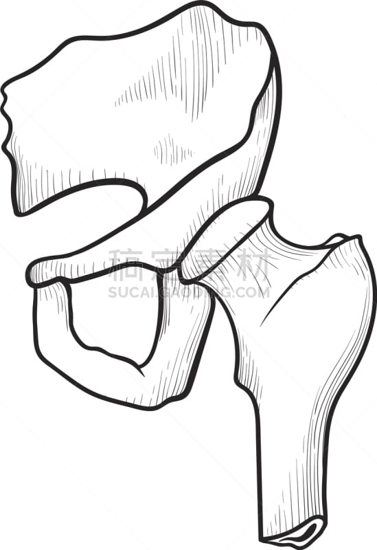 插画,髋部,医疗标志,计算机图标,生物学,健康保健,髂骨,骨盆,骨折