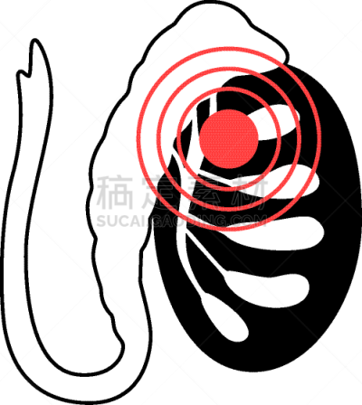 男性生殖系统,生物学,健康保健,睾丸,门诊部,品牌名称,人类的生殖器官,人类腺体,问题