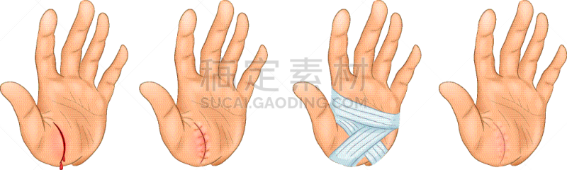 易接近性,毛细血管,疤,人,红色,身体受伤,出血