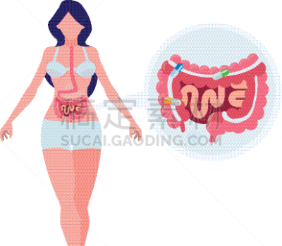 人类消化系统,女性,生物学,健康保健,人,溃疡,直的,生病,联系