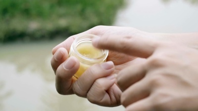 妇女涂抹软膏蚊虫叮咬