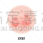 囊肿,粉刺,计算机图标,果皮,字体,胞囊的,模板,疤,生病,美容