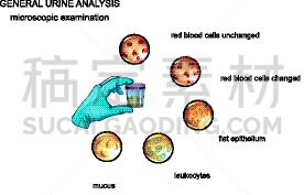 尿液,白色,生物学,分离着色,商务,微生物学,健康保健,分析,生病