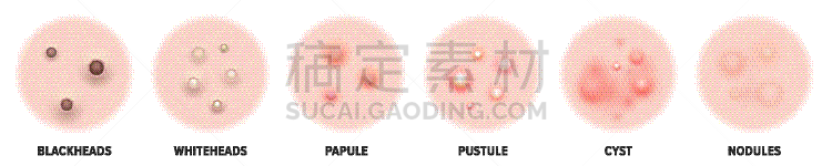 粉刺,果皮,字体,似人脸,胞囊的,模板,疤,建造物,问题,美容