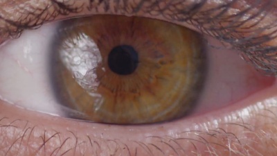 睁眼闪烁宏关闭慢动作200fps  