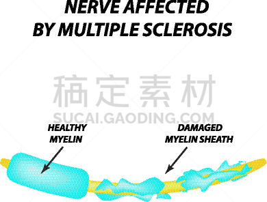 轴突,髓鞘,生物学,健康保健,有髓鞘的,整形器具,神经科学