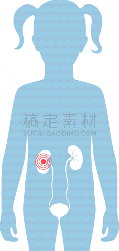 肾脏,分离着色,儿童,泌尿系统,输尿管,尿道,膀胱,人,女人