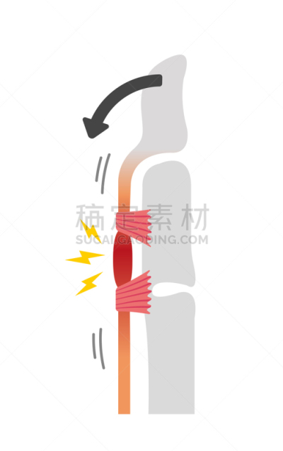 扳机,手指,绘画插图,背景分离,药,坏掉的,手部骨骼,情绪压力
