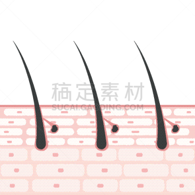 皮肤,绘画插图,横截面,皮脂腺,汗腺,分泌腺的,细胞,头发,体味