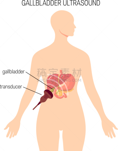 胆囊,概念,超声波,胆汁,膀胱,女人,锐角,白色,胆石,生病