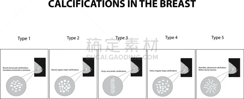 顺序,放射科专家,健康保健,技术,门诊部,女人,设备用品,人类腺体