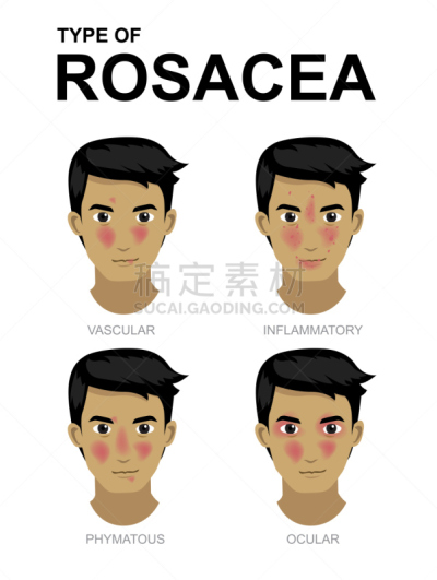 男人,日本漫画,肿胀的,溃疡,健康保健,水泡,皮炎,皮肤病学,维管束,人的脸部