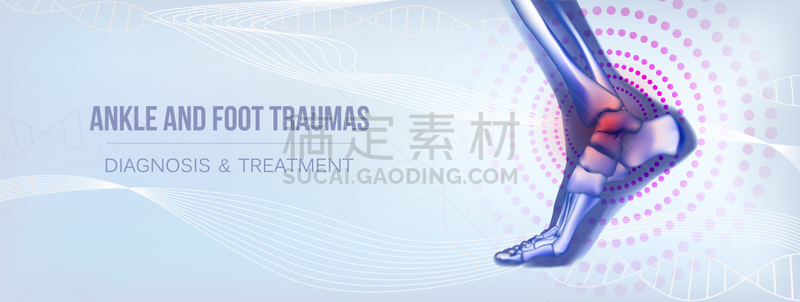 踝,水平画幅,动物足,风湿病,传媒,健康保健,建造物,三维图形,写实