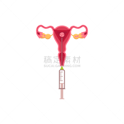 卵子,人工授精,婴儿,卵巢,子宫颈,人,女人,问候