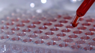 科学家滴入化学溶液进行分析 全息图化学结构和未来技术中的白血病细胞用于实验室测试