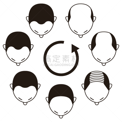 图表,人的头部,非全秃,数据,男性,健康保健,除痣,头发,前额,线条画