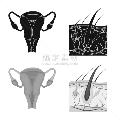 人,计算机图标,人类的生殖器官,卵巢,头皮,头发,生病,收集