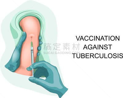 结核杆菌,注射器,健康保健,不卫生的,人,白细胞,咳嗽,生病