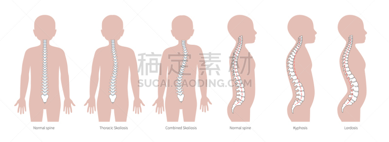 绘画插图,男孩,矢量,整形器具,平坦的