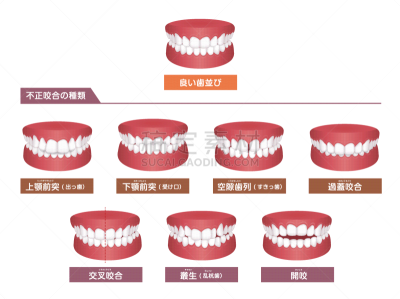 人的牙齿,绘画插图,咬,日本,矢量,口腔卫生,健康保健,部分,龋齿,牙医