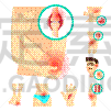 品牌名称,痛苦,分离着色,身体受伤,饥饿的,图像,肚子,生病,收集,骨折