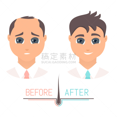 男人,正面视角,药,脱发,改变
