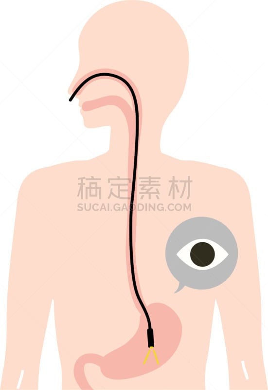 绘画插图,检查,平衡折角灯,代表,粘液,健康保健,背景分离,癌症,粘膜,医疗流程