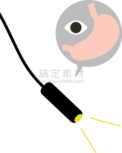 绘画插图,代表,平衡折角灯,粘液,健康保健,医学检测,背景分离,癌症,粘膜,医疗流程