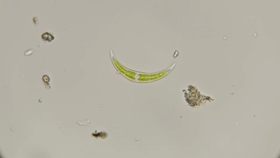 显微镜下的硅藻Klosterium