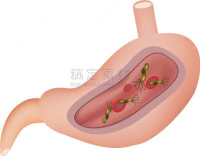 幽门螺旋杆菌,胃,粘膜,生物学,微生物学,健康保健,显微镜,溃疡,动物十二指肠