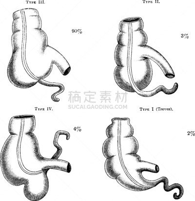 盲肠,四个物体,白色,矢量,图像,雕刻图像,黑色,复古