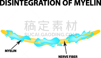 轴突,髓鞘,生物学,健康保健,有髓鞘的,整形器具,神经科学