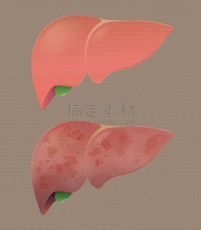 肝脏,健康生活方式,健康保健,药,癌症,细胞,结肠炎,肝炎,病毒,背景