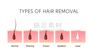 比较,除痣,有序,平视角,多样,腿,模板,毛囊,女人,头发