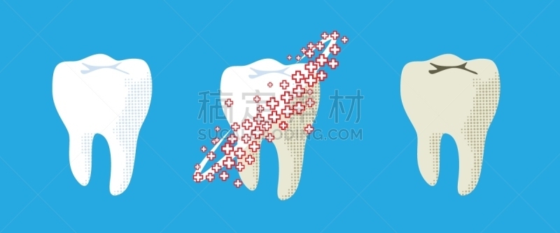 痕迹,健康保健,珐琅,牙医,变形链球菌,背景,绘画插图,问题,炎症,使用嘴巴