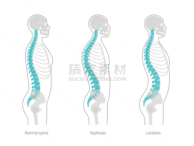 绘画插图,矢量,生物学,畸形,有序,健康保健,姿态,背景分离,肖像,脖子