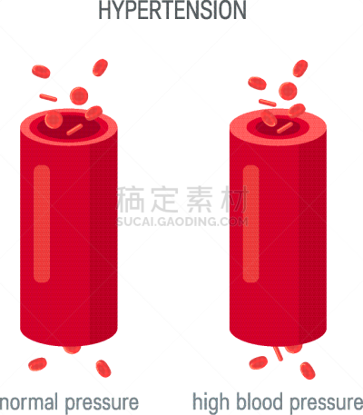 概念,血压计,扁平化设计,白色,分离着色,信息图表,健康保健,狭窄的,人,生病