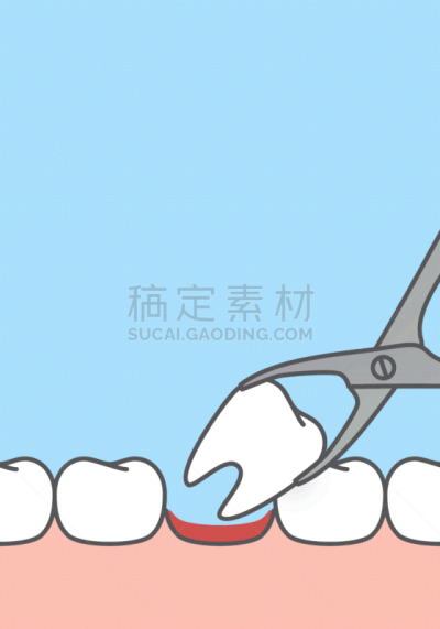 口腔卫生,绘画插图,空白的,概念,镊子,矢量,牙齿,设计,移开