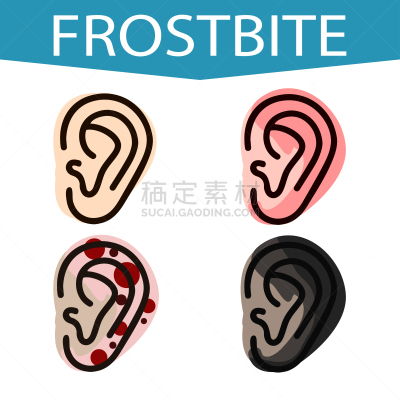 人的耳朵,冻疮,矢量,体温过低,绘画插图,草,分离着色,发展,设计